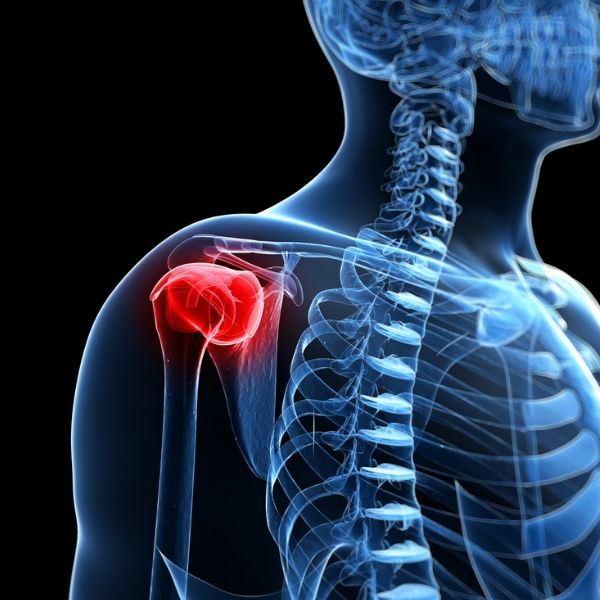 Shoulder Arthritis Pain | Shoulder Specialist | Boise, Meridian, Nampa,  Treasure Valley